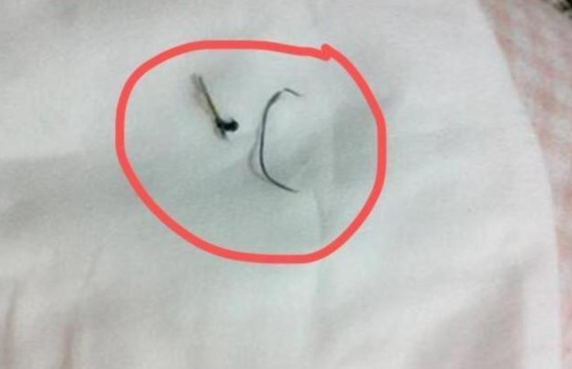 “妈妈,我的脚进虫子了”,宝妈赶紧上医院,医生:还好来得早