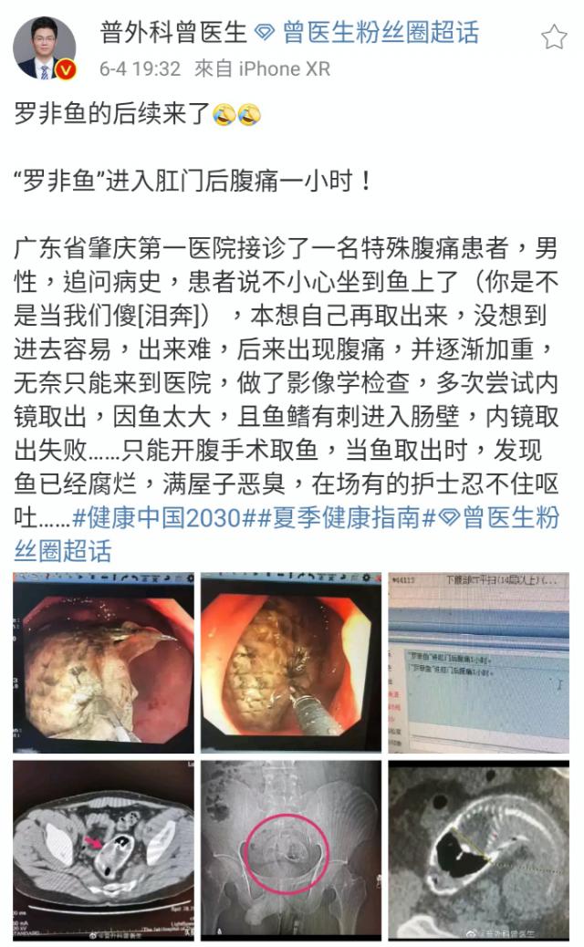 罗非鱼直肠,罗非鱼塞进直肠多长时间