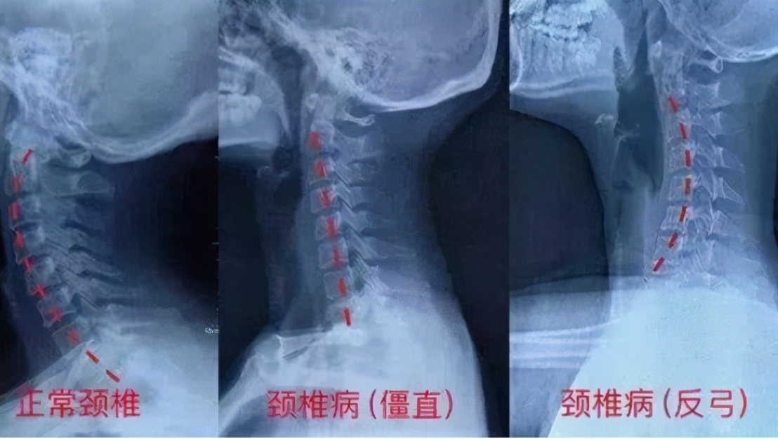 孩子经常头晕头痛怎么回事,孩子一阵阵头疼眩晕怎么回事