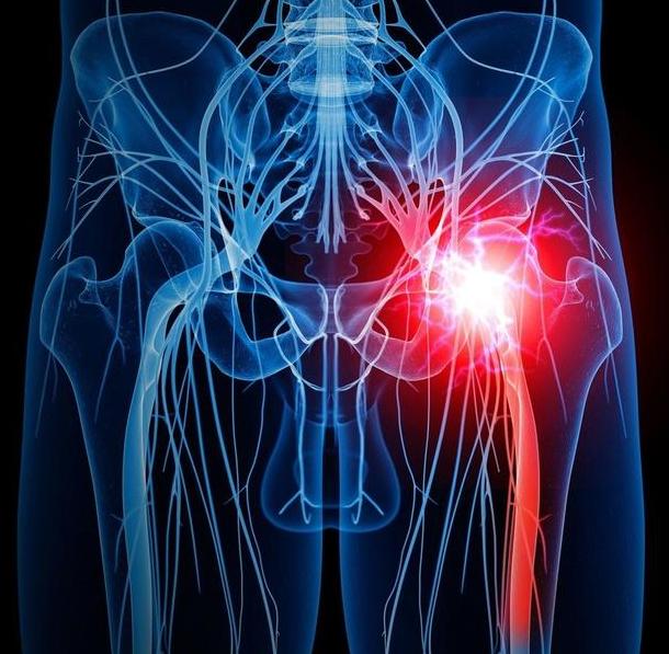 总是感觉腰疼腿酸怎么回事,腰疼屁股疼什么原因引起的