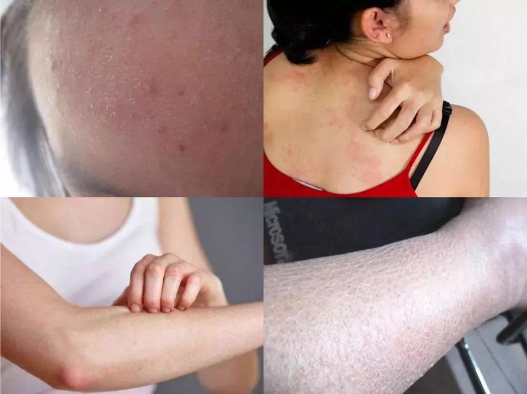 买大几千的护肤品不如一瓶虾青素,重金买精华有用吗