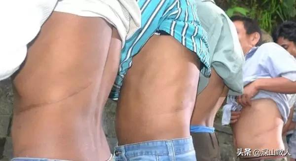 印度“卖肾村”，男性为摆脱贫困，割肾也没有致富！