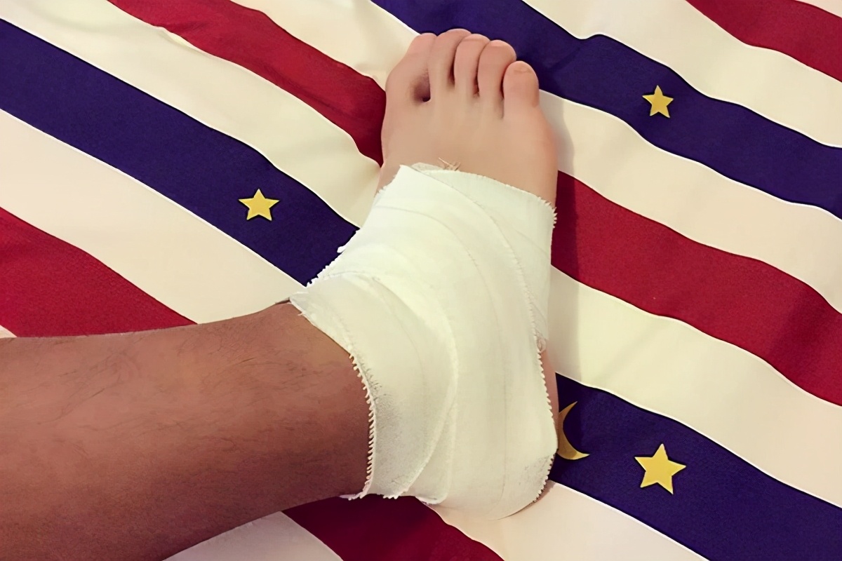 烫伤后皮肤是怎么恢复的,烫伤后皮肤是怎么修复的