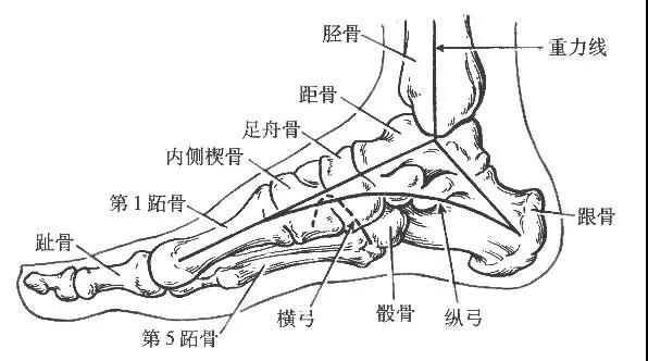 什么是扁平足？日常生活要怎样预防呢？
