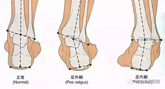 为了您的健康原版,为了您的健康保驾护航