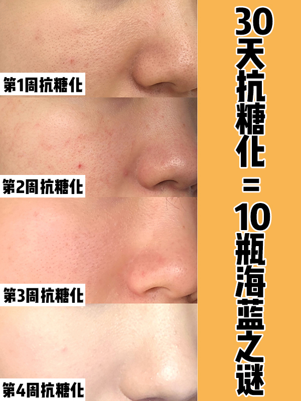 坚持1个月抗糖化，效果比10瓶海蓝之谜都好！4周白2度皮肤超水润