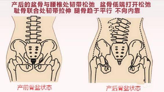 “尿裤子”的尴尬，女人的难言之隐，你有了解过吗