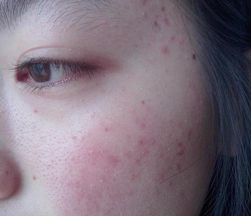 雅漾喷雾和理肤泉喷雾哪个好,雅漾喷雾和理肤泉喷雾有什么区别