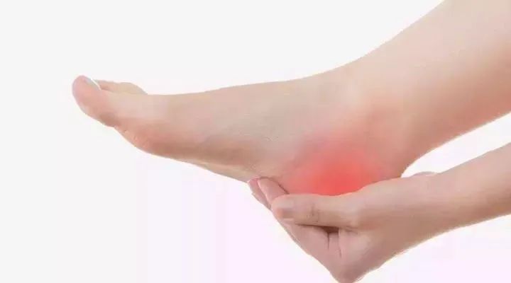 足跟痛针灸效果好吗,足跟痛针灸视频大全