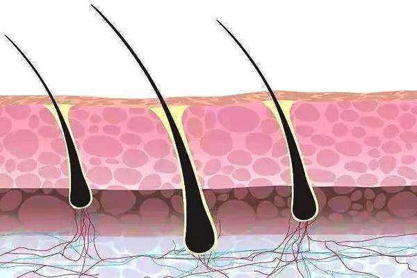 儿童休止期脱发,儿童头发脱发一小块