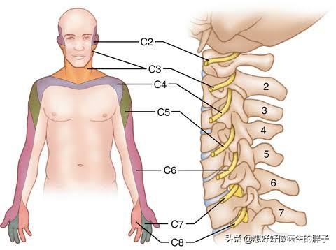 颈椎骨刺压迫神经怎么治疗,颈椎间盘突出压迫神经的症状