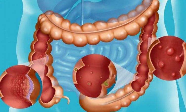 喝茶胃难受吃什么药,喝茶脾胃不好