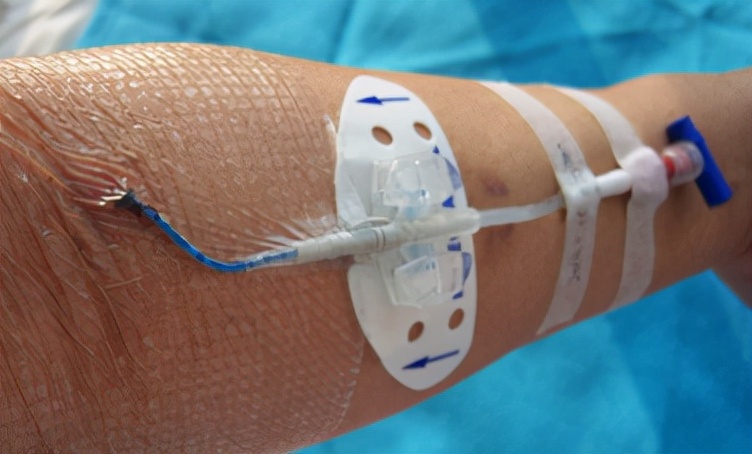 化疗反应重怎么处理,化疗反应大是怎么处理