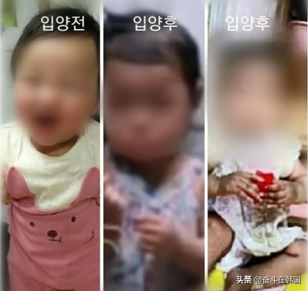 内脏破裂的小孩,腹腔脏器破裂的病人死亡的原因