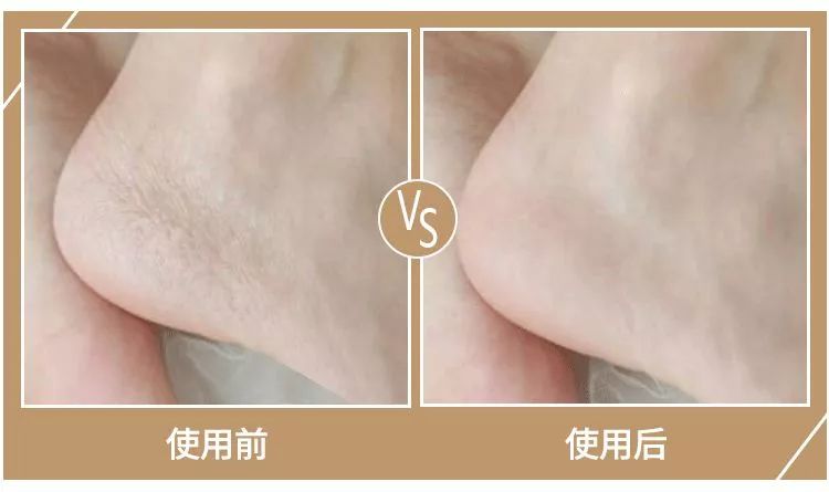 妮娜泰勒是谁,妮娜泰勒的手