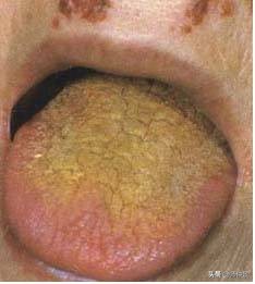 最实用的舌诊图六大舌象,舌诊深入学习书