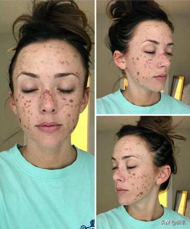 自嘲整容,承认整容七年的姐姐