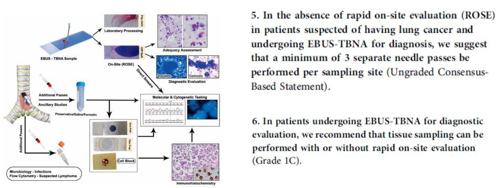 孙加源门诊,治疗肺癌的新技术新手段