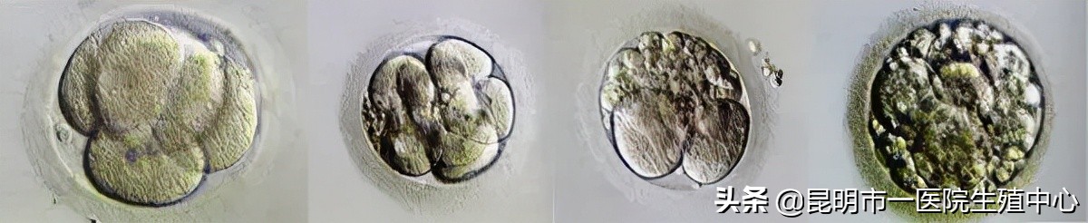 试管小白——“顶流”级别的胚胎长啥样？