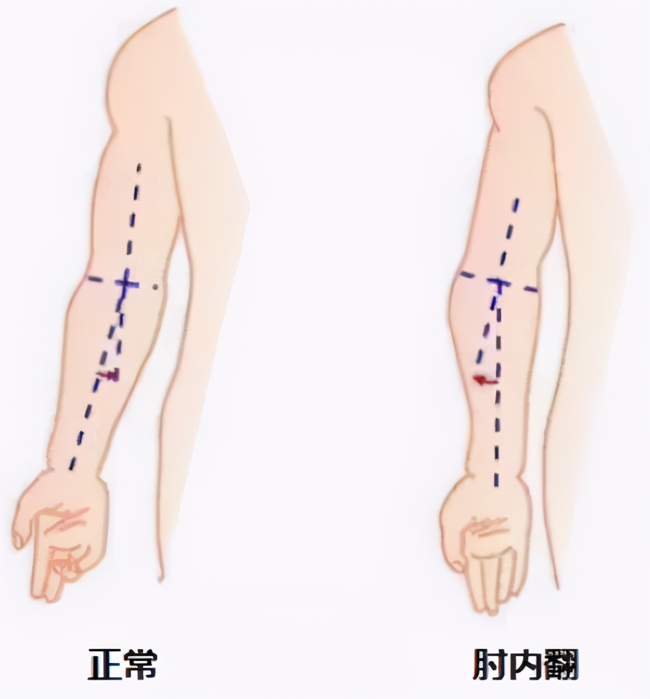 这个小伙子，胳膊肘真是往外拐的......