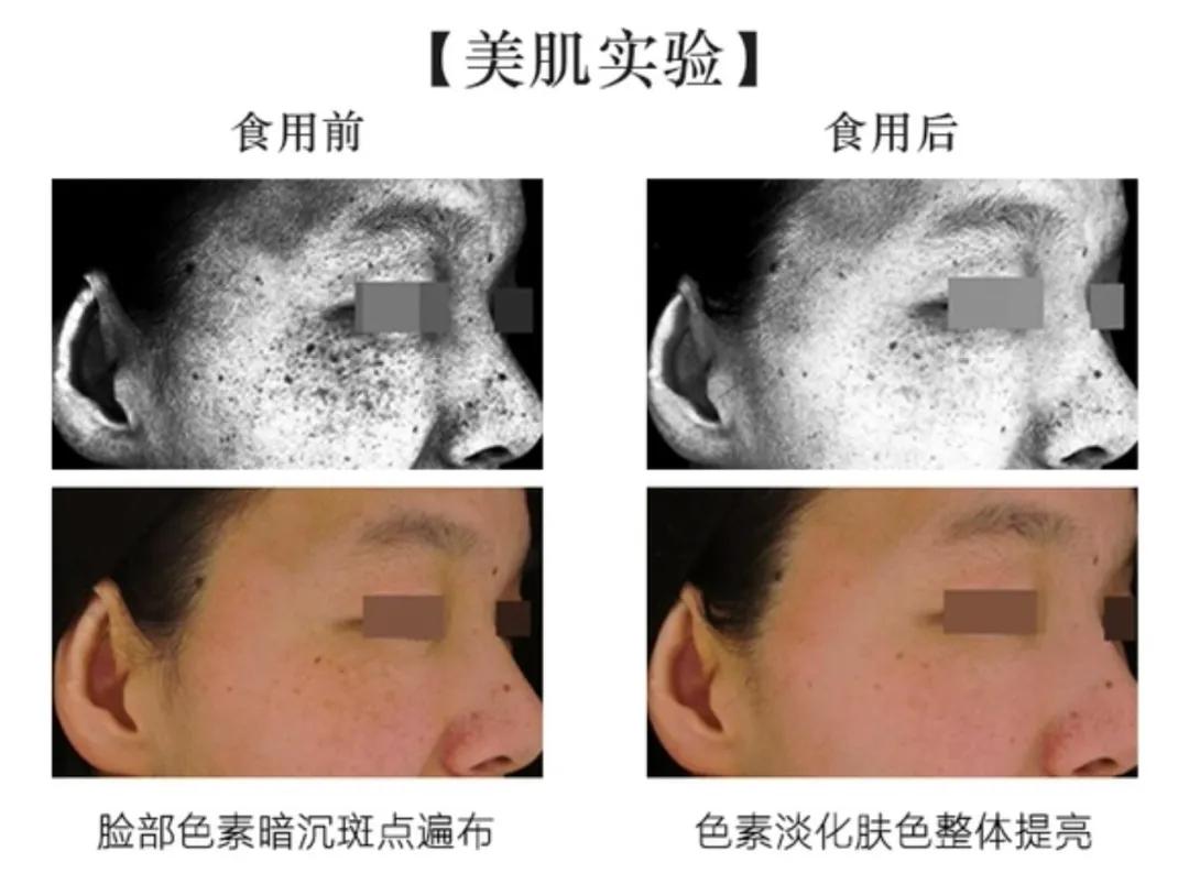 如何一年四季白到发光,夏天白到发光的秘诀