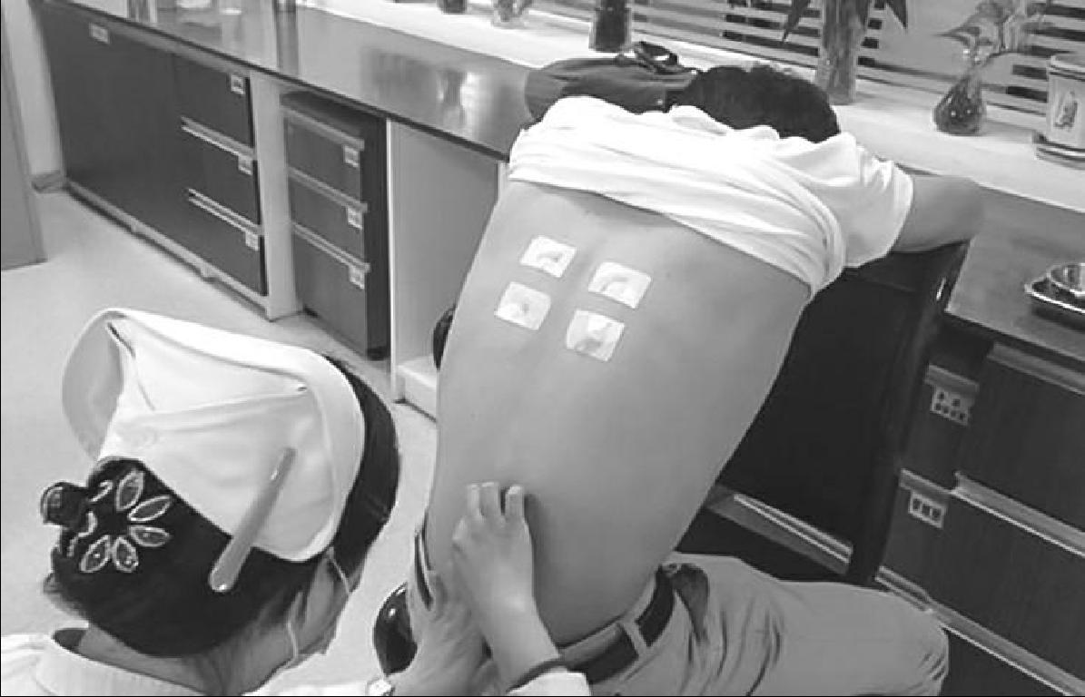 中医治疗类风湿性关节炎中成药,类风湿关节炎中医西医结合方案