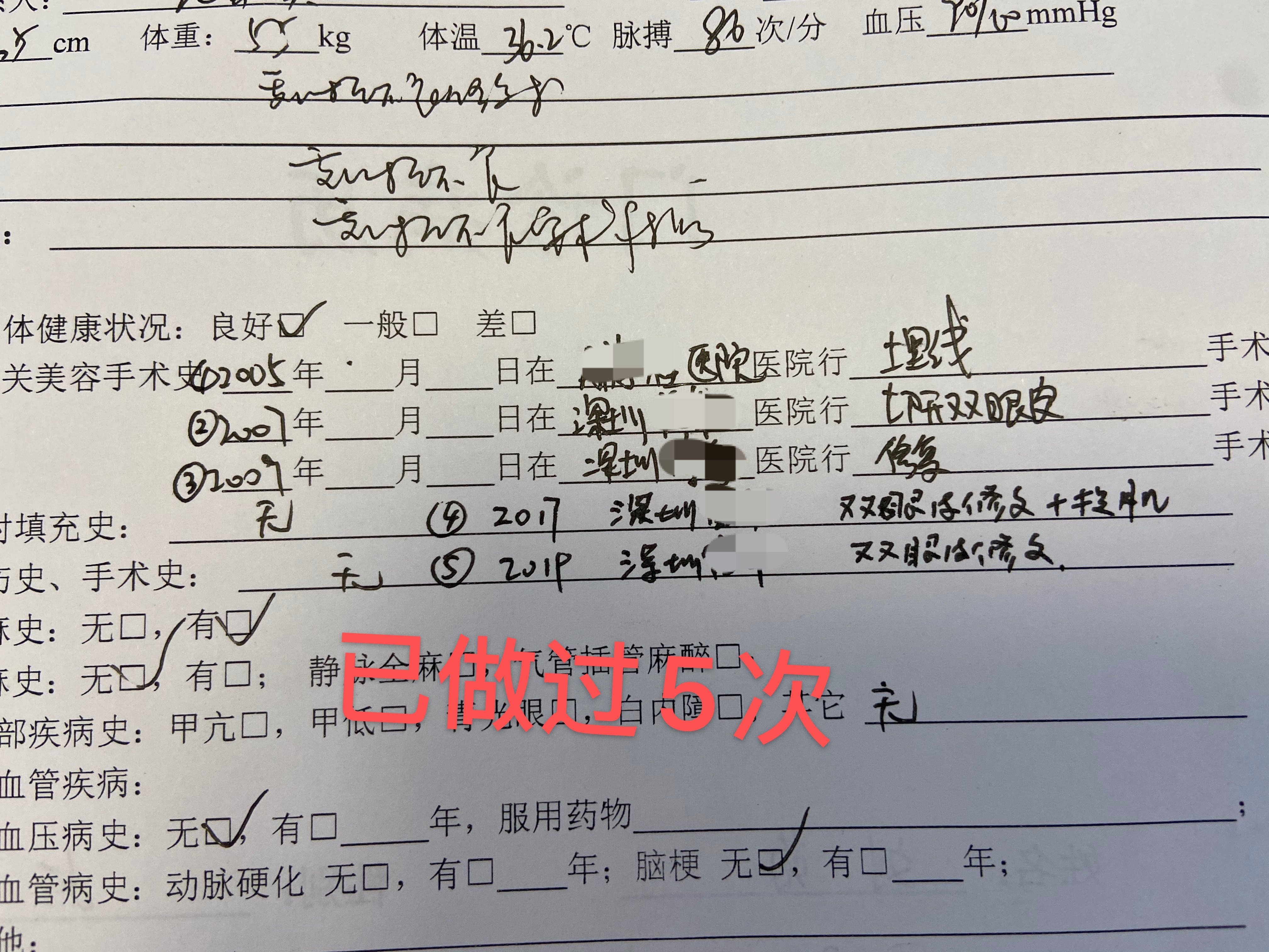 高难度修复双眼皮宽改窄恢复期,高难度双眼皮修复案例