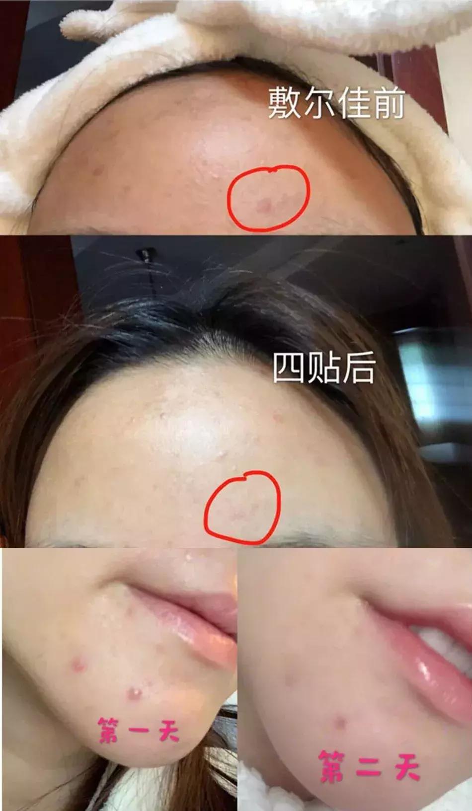 这几种超级好用的面膜你用过吗,哪款面膜才是真正有用的面膜