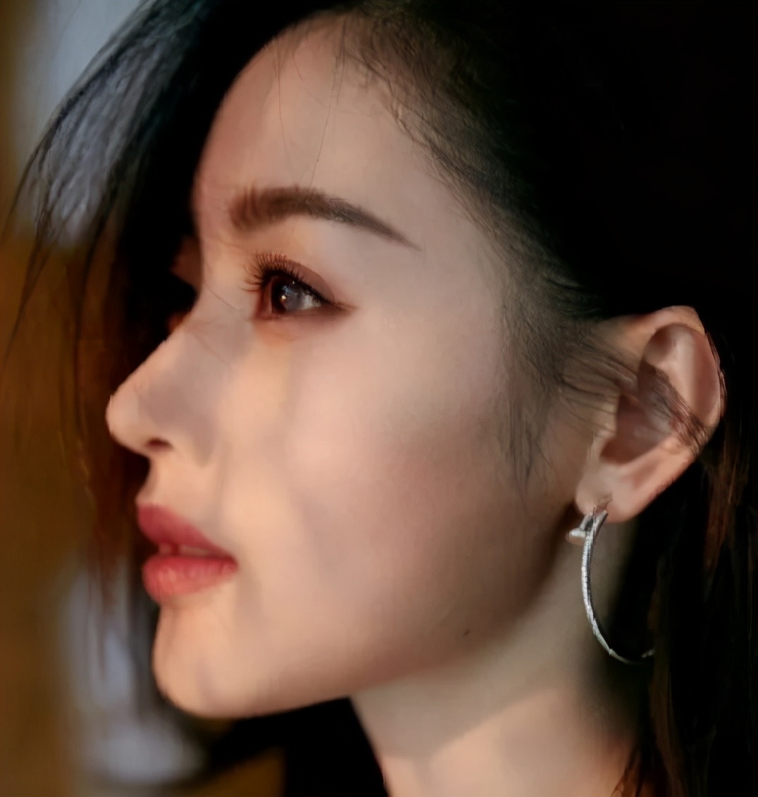 蒜头鼻怎么自己矫正,蒜头鼻塌鼻梁朝天鼻怎么改善