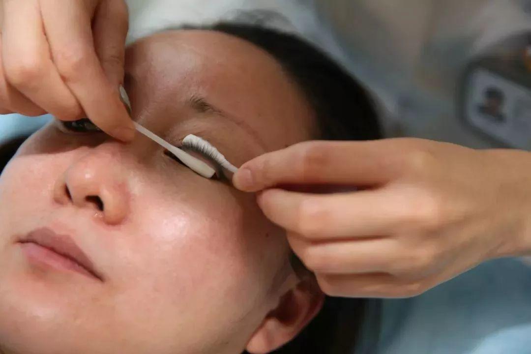 春季卡他性结膜炎会引起失明吗,什么原因引起的春季卡他性结膜炎