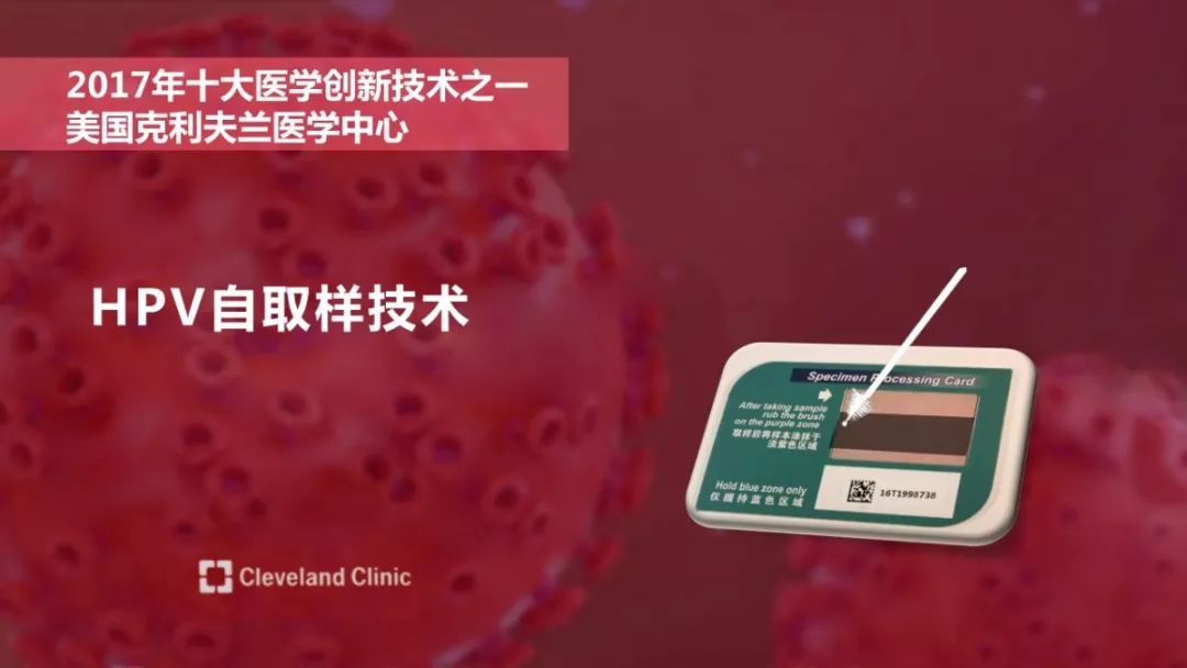 宫颈癌双筛的报告解读,宫颈癌最深度解读