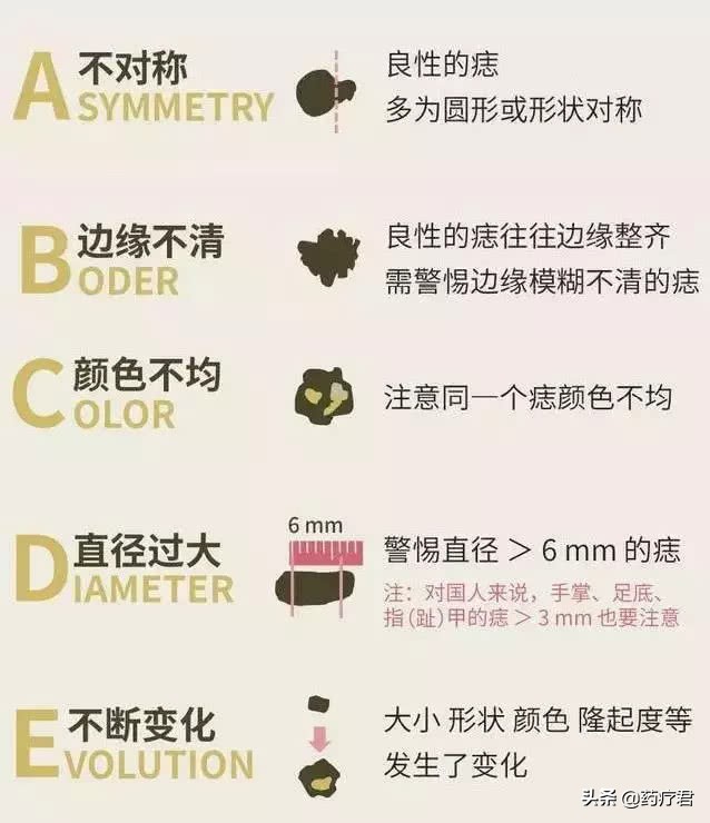 脚底长了个硬疙瘩病理检查恶性,脚底恶性肿瘤常见吗