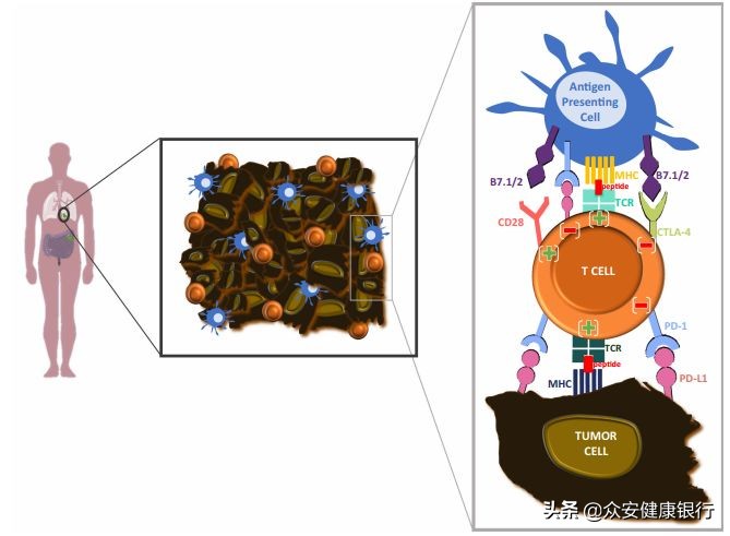 免疫治疗早期肺癌的效果如何,免疫治疗晚期肺癌的治愈率