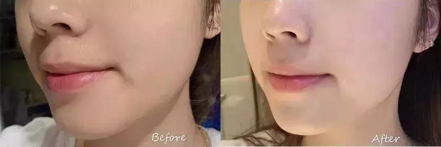 沈梦辰美白精华,沈梦辰推荐的美白精华液