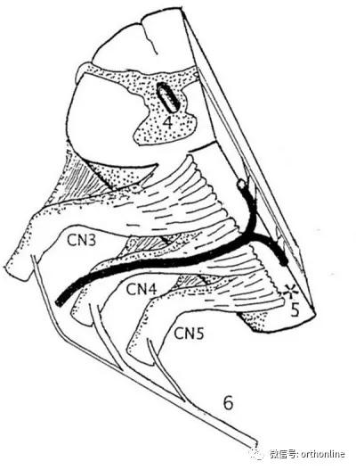 非单一类型颈椎病患者什么意思,颈椎病罕见吗好治吗