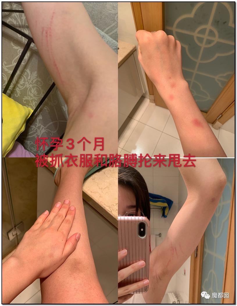 短跑名将张培萌家暴事件,短跑名将张培萌殴打岳母视频