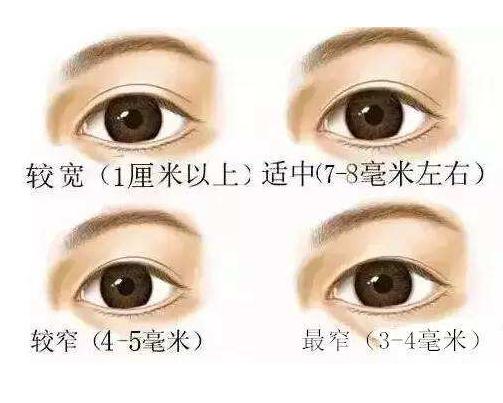 余文林整容后需要住院多久,余文林失败案例