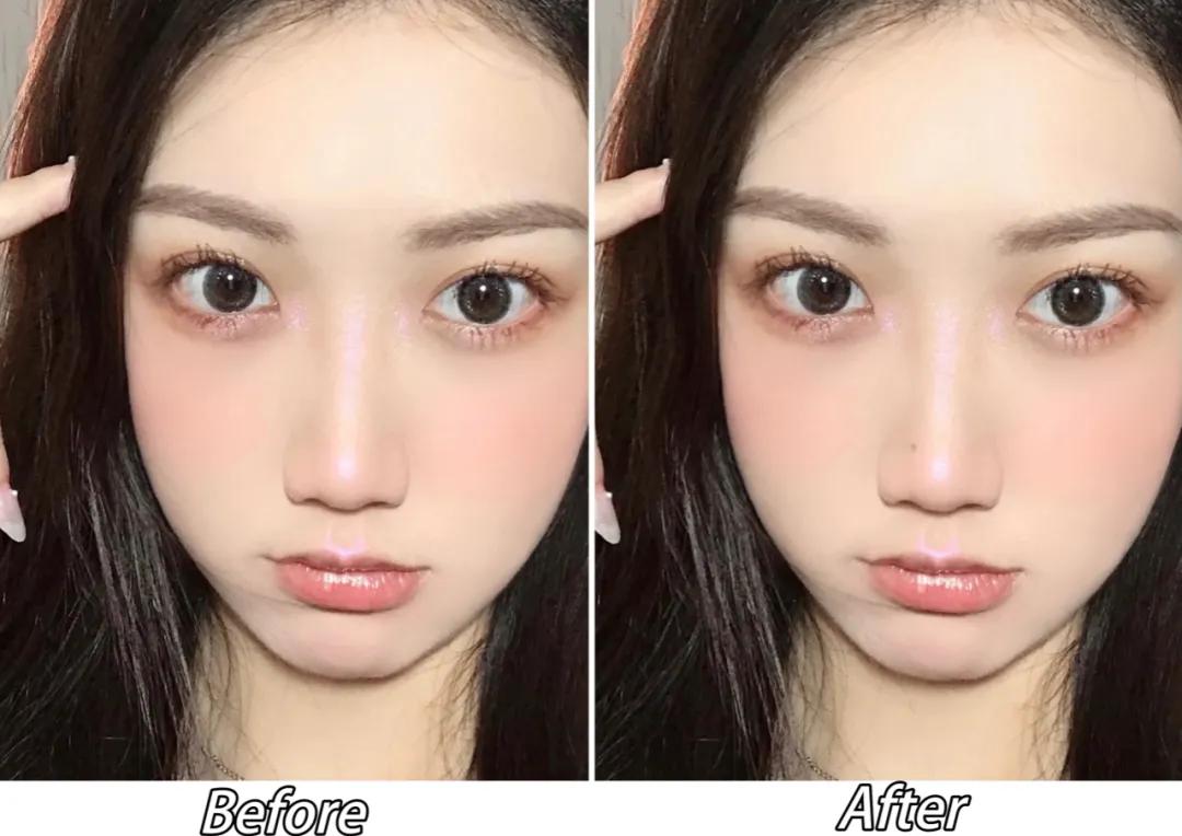 全脸点痣变美,点痣能变美吗