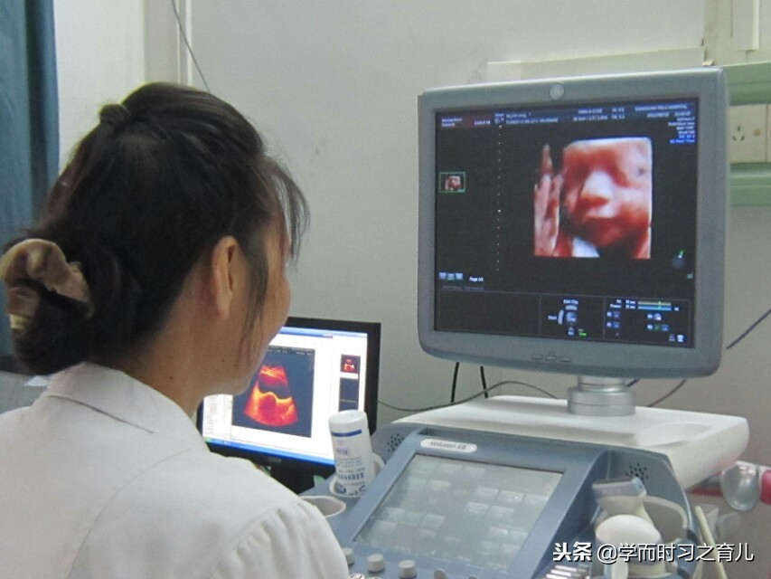 怀孕1到10个月需要注意什么,怀孕期间1-10个月的注意事项