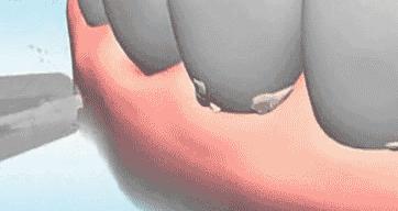 牙科诊所里你不知道的事,口腔医生提醒