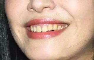 全球10款真正好用的人气牙膏,盘点全球9款真正好用的人气牙膏