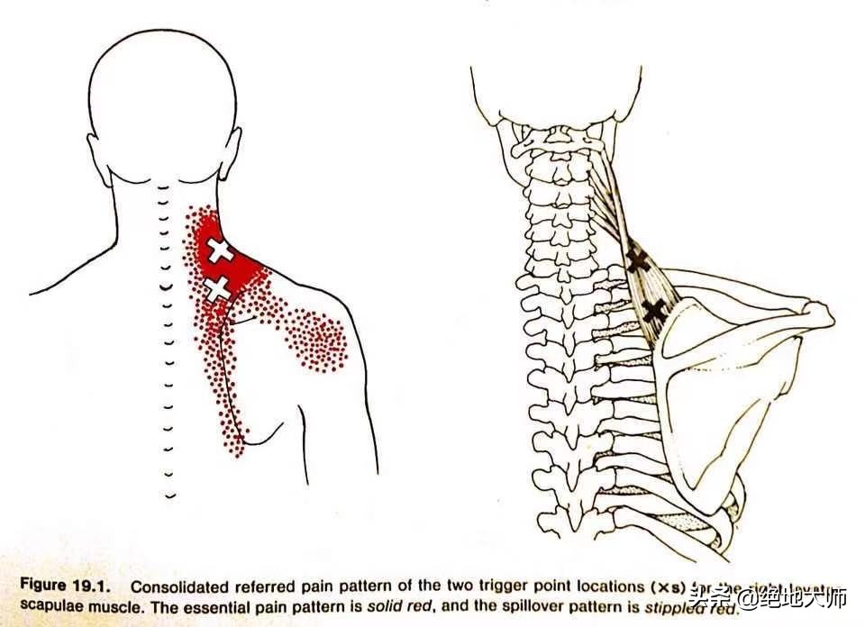 肩胛疼痛为何要做康复,肩胛区疼痛治疗