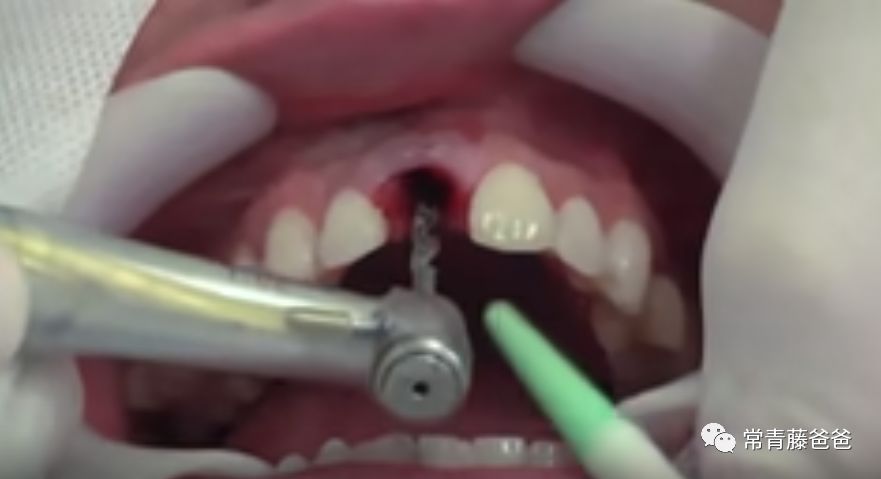 爱牙日保护你的口腔健康,爱牙日从定期口腔检查开始