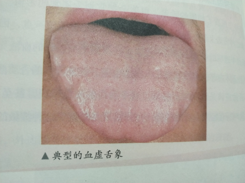 别人不冷自己却感觉冷,别人都不冷就自己冷怎么回事