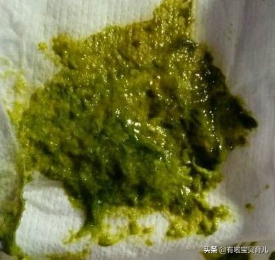 宝宝拉绿便不怎么长肉喝什么奶粉,宝宝拉绿色便便是妈妈吃凉的了吗