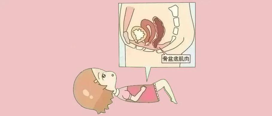 剖腹产能避免分娩疼痛吗,剖腹产能避免盆底肌松弛吗