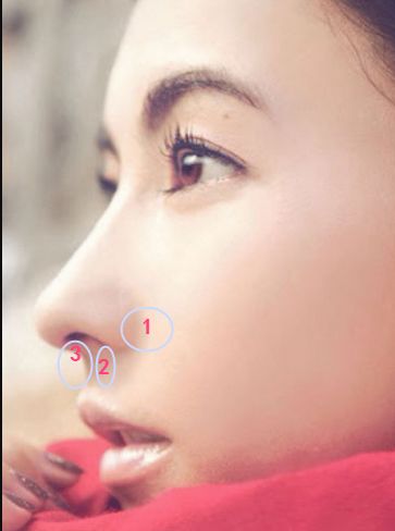 贵族手术的好处,鼻基底手术失败凹陷怎么改善