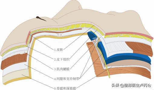 微创悬吊除皱术和拉皮的区别,成都拉皮手术除皱术价格