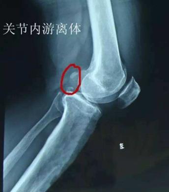 犬分离性软骨病,犬的主要疾病有哪些