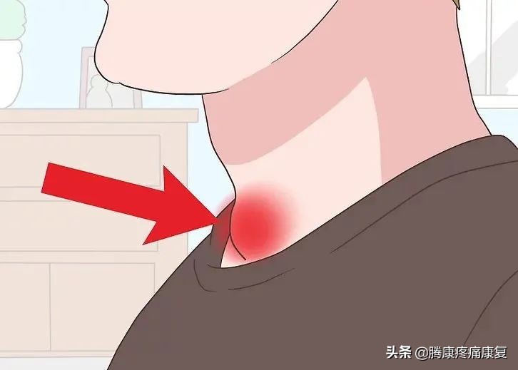 桥本甲状腺炎90天治疗方案,nac对桥本甲状腺炎的作用